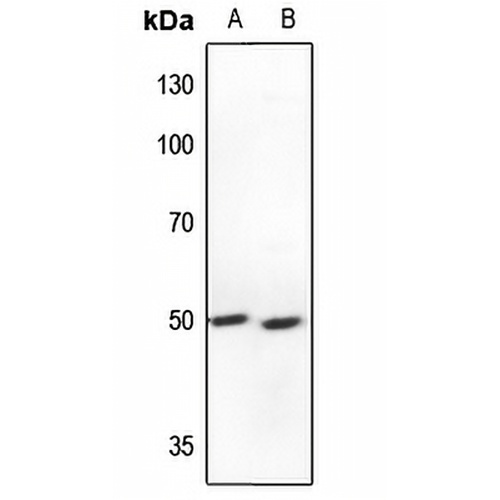 S6K2 Rabbit Polyclonal Antibody