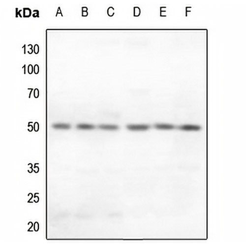 Secretin Receptor Rabbit Polyclonal Antibody