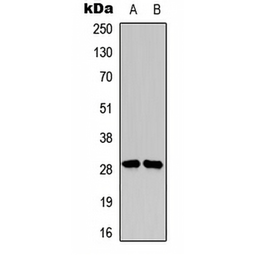 SNAI1 (Phospho-S246) Rabbit Polyclonal Antibody