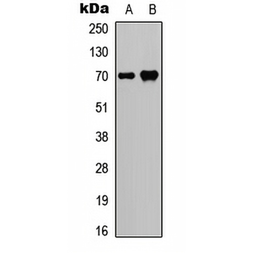 SPHK2 (Phospho-T614) Rabbit Polyclonal Antibody