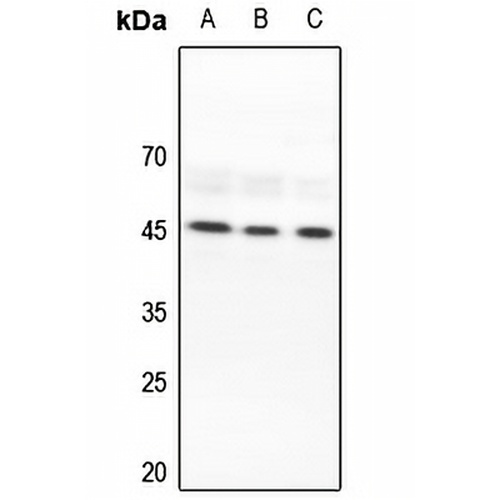 Lupus La Rabbit Polyclonal Antibody