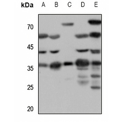 SSTR1 Rabbit Polyclonal Antibody