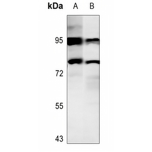 STAT4 (Phospho-Y693) Rabbit Polyclonal Antibody