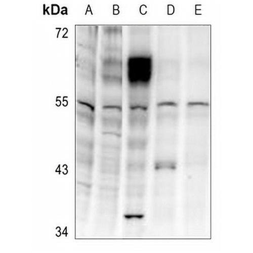 LKB1 (Phospho-T189) Rabbit Polyclonal Antibody