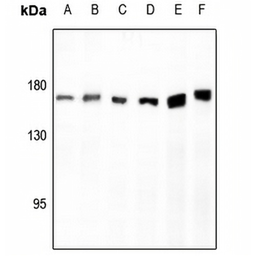 AS160 Rabbit Polyclonal Antibody