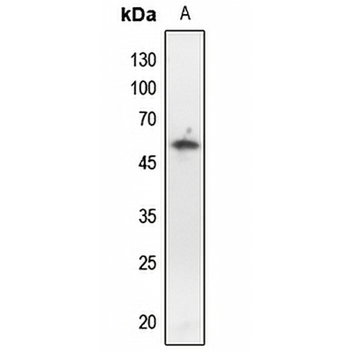 p53 (Phospho-T18) Rabbit Polyclonal Antibody