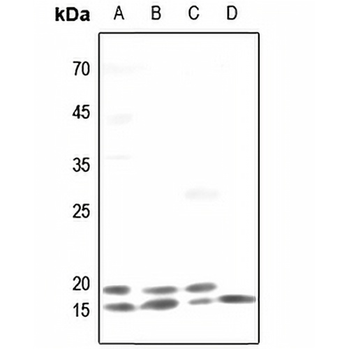 TRAPPC3 Rabbit Polyclonal Antibody