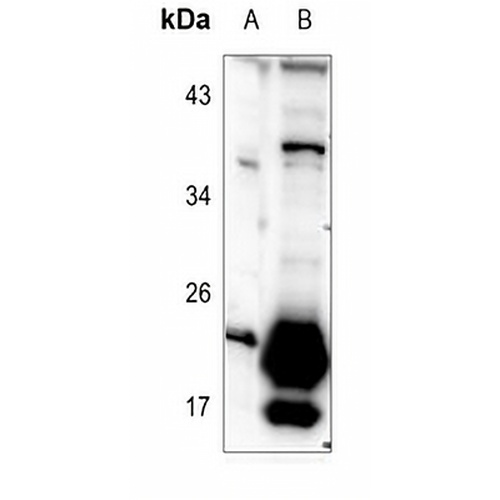 TUSC5 Rabbit Polyclonal Antibody
