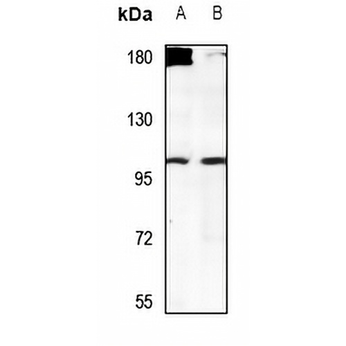 USP38 Rabbit Polyclonal Antibody