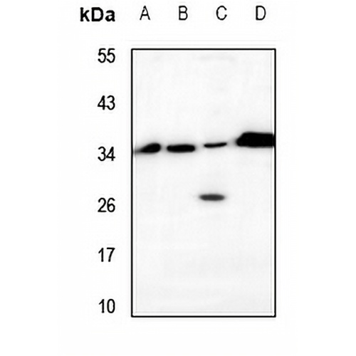 VTI1B Rabbit Polyclonal Antibody