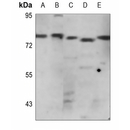 WASF1 Rabbit Polyclonal Antibody