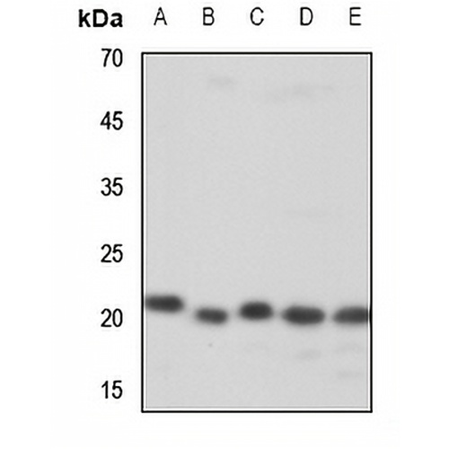 ZNF695 Rabbit Polyclonal Antibody