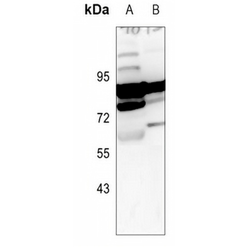 ARHGEF7 Rabbit Polyclonal Antibody