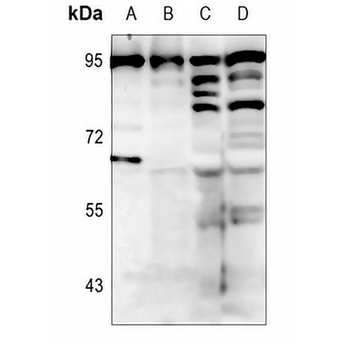 BCL6 Rabbit Polyclonal Antibody