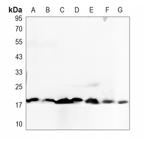 Caspase 8 p18 Rabbit Polyclonal Antibody