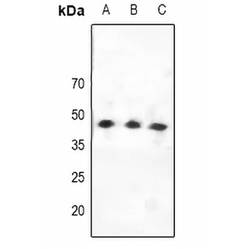 CCKAR Rabbit Polyclonal Antibody