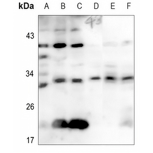 CD69 Rabbit Polyclonal Antibody