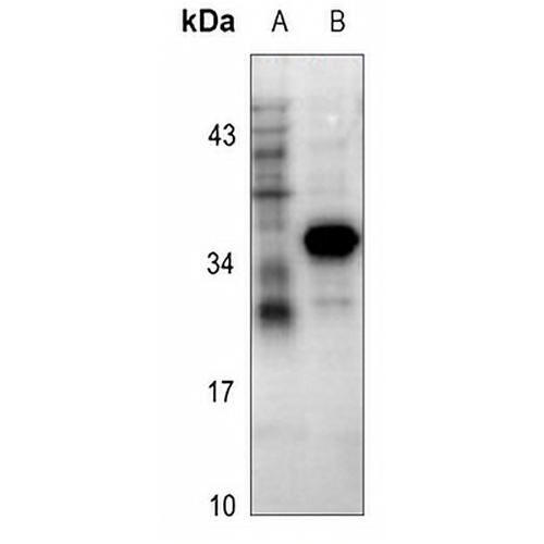 Cathepsin B Rabbit Polyclonal Antibody