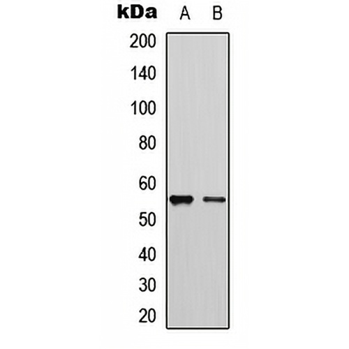 Cytochrome P450 2D6 Rabbit Polyclonal Antibody