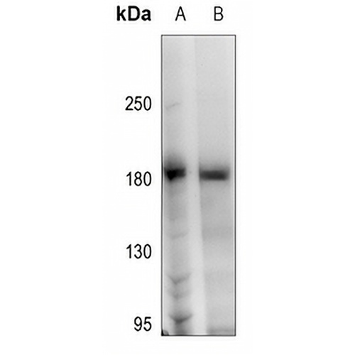 HER2 (Phospho-Y1248) Rabbit Polyclonal Antibody