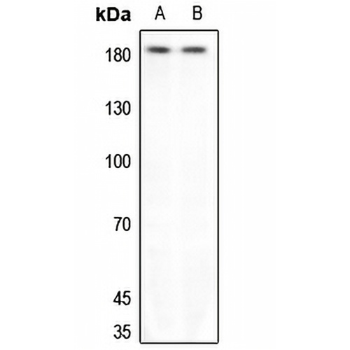 HER3 Rabbit Polyclonal Antibody