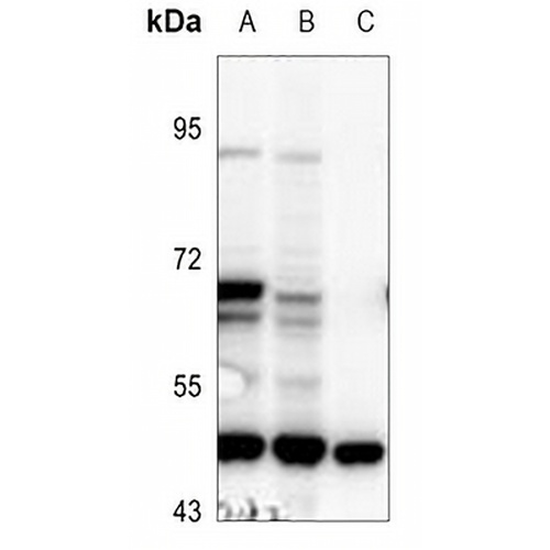 IFIT5 Rabbit Polyclonal Antibody