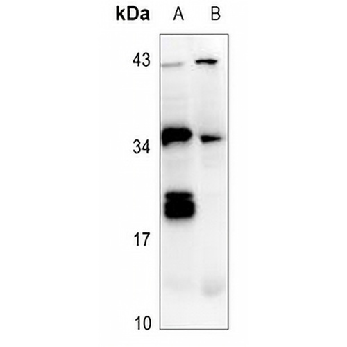 IL-26 Rabbit Polyclonal Antibody