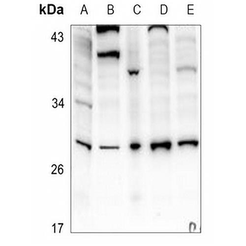 IL-6 Rabbit Polyclonal Antibody