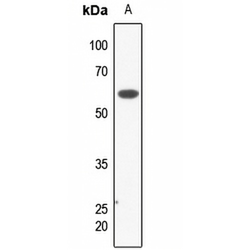 KCNK3 Rabbit Polyclonal Antibody