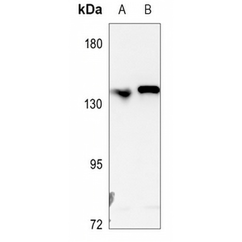L1CAM Rabbit Polyclonal Antibody