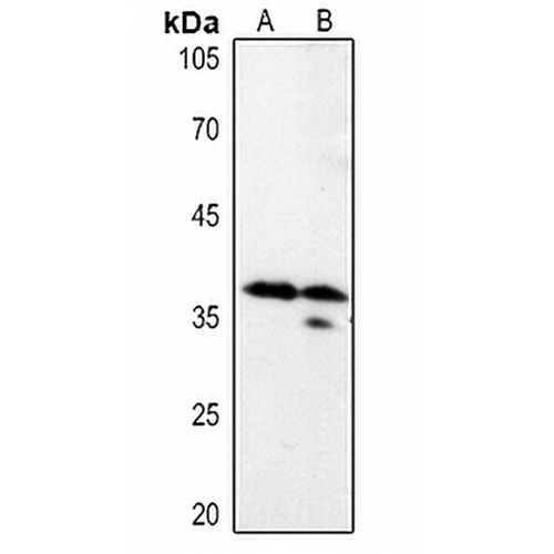 LASP1 Rabbit Polyclonal Antibody