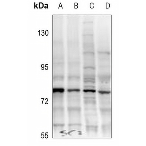 TAK1 (Phospho-T187) Rabbit Polyclonal Antibody