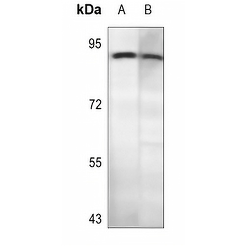 CD56 Rabbit Polyclonal Antibody