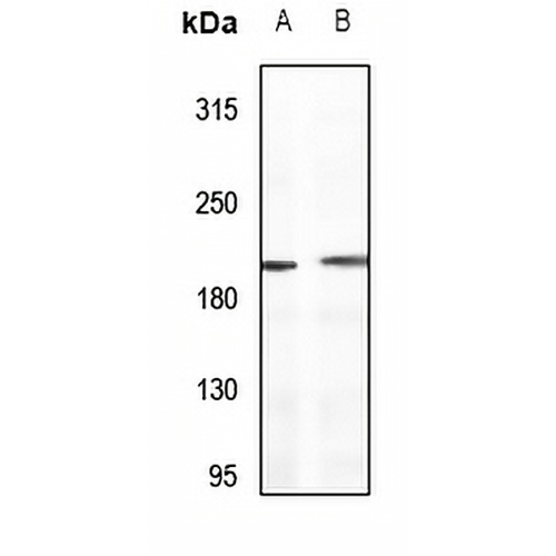 Sugen Kinase 269 Rabbit Polyclonal Antibody