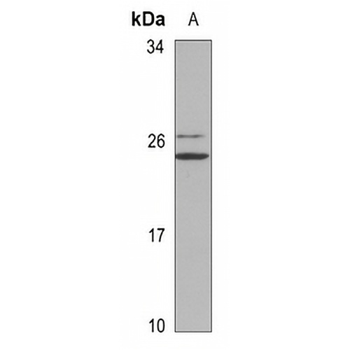 POLR3H Rabbit Polyclonal Antibody