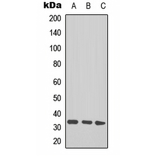TAL1/2 (Acetyl-K221+222/K36+37) Rabbit Polyclonal Antibody