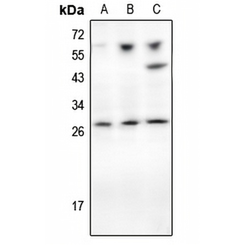 TIMP1 Rabbit Polyclonal Antibody