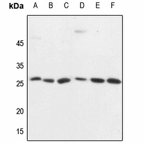 CD137 Rabbit Polyclonal Antibody