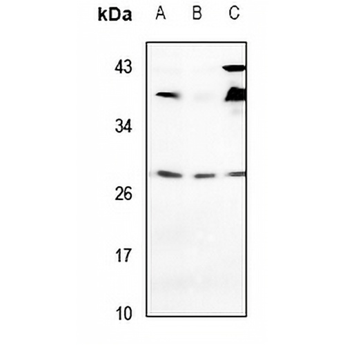 VTI1A Rabbit Polyclonal Antibody