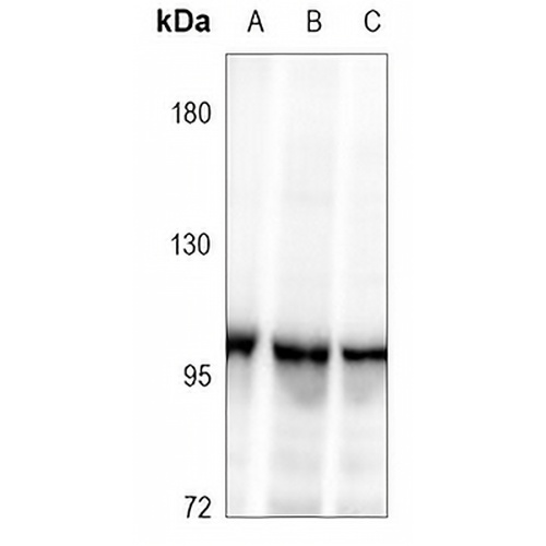 XRN2 Rabbit Polyclonal Antibody