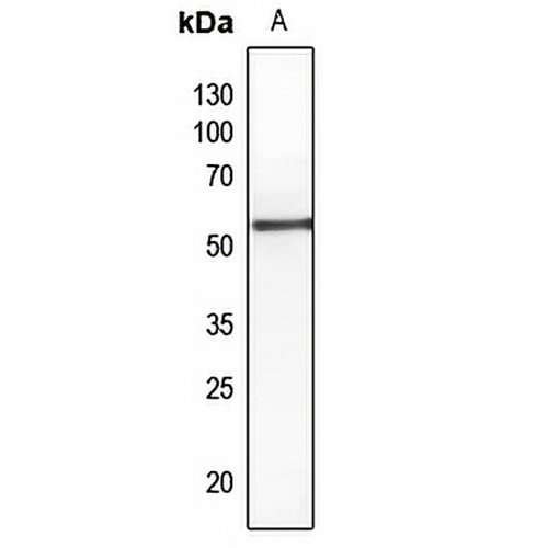 PTEN (Phospho-S380/T382/T383) Rabbit Polyclonal Antibody