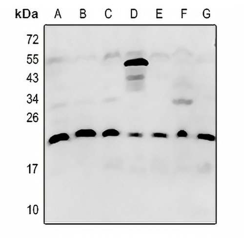 p21 Rabbit Polyclonal Antibody