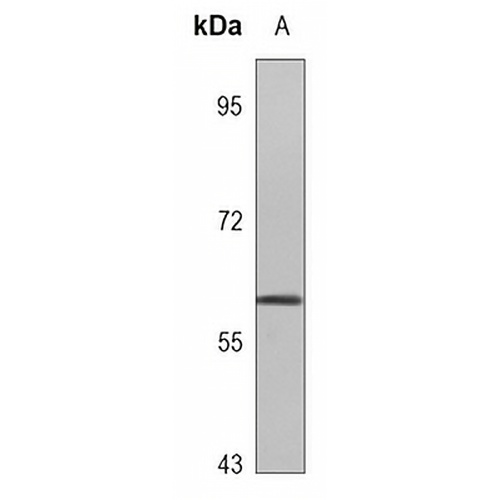 PHF1 Rabbit Polyclonal Antibody