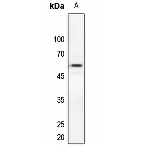 Dyskerin Rabbit Polyclonal Antibody