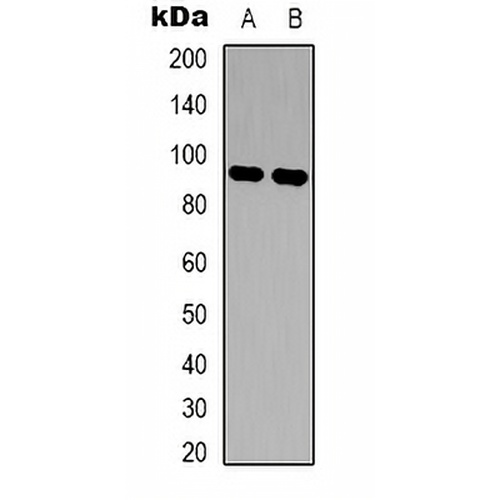 c-FER Rabbit Polyclonal Antibody