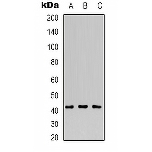 MVK Rabbit Polyclonal Antibody