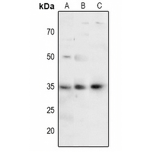 FOXE3 Rabbit Polyclonal Antibody