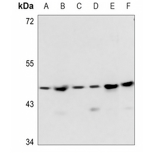 PSMD11 Rabbit Polyclonal Antibody