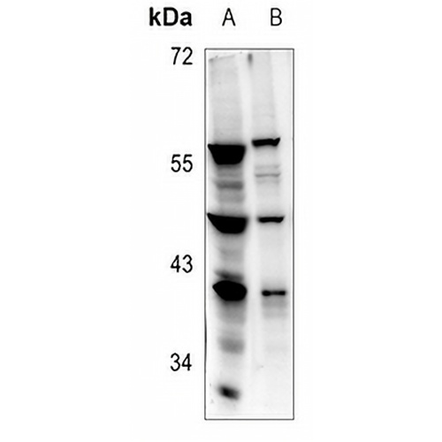 RPL5 Rabbit Polyclonal Antibody