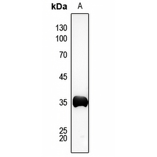 AKR1C2 Rabbit Polyclonal Antibody